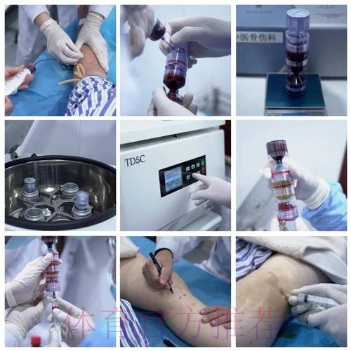 居勒尔将接受富血小板血浆注射 若没效果就将手术 居勒尔将接受富血小板血浆注射 若没效果就将手术